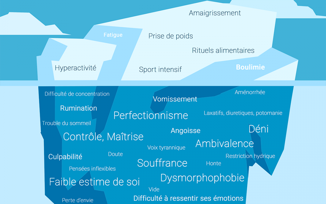 Qu’est-ce qu’un trouble des conduites alimentaires (TCA) ? Le quiz des préjugés.